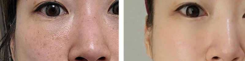 �A�~�I�NTREECICA:U JxCOLLABO sns�l�C�����قǕς�锧�o�����ʔ����T�C�g